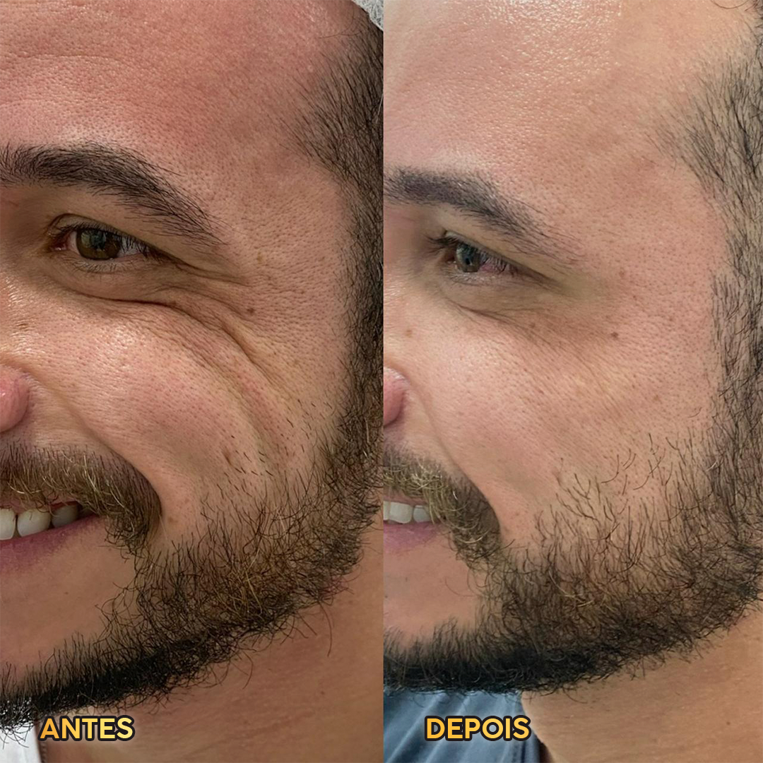 Resultado HOF Master