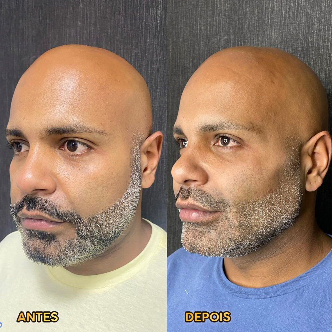 Resultado HOF Master