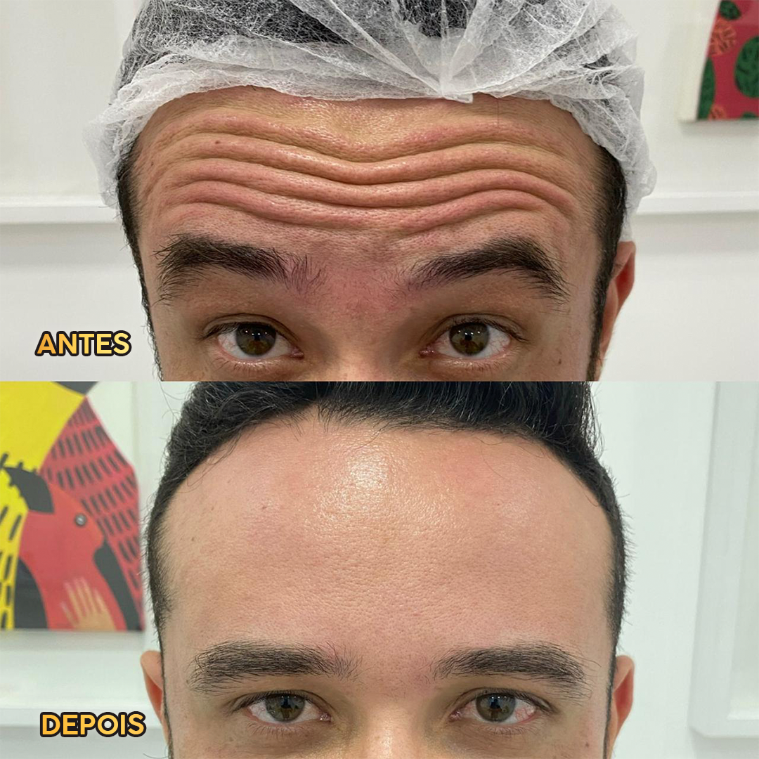 Resultado HOF Master